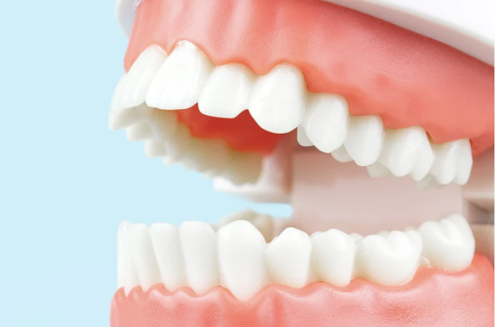 medical model of a jaw